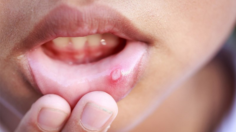 “Cây nhà lá vườn” nhưng cực kỳ hiệu quả trong việc điều trị bệnh tiểu đường 2